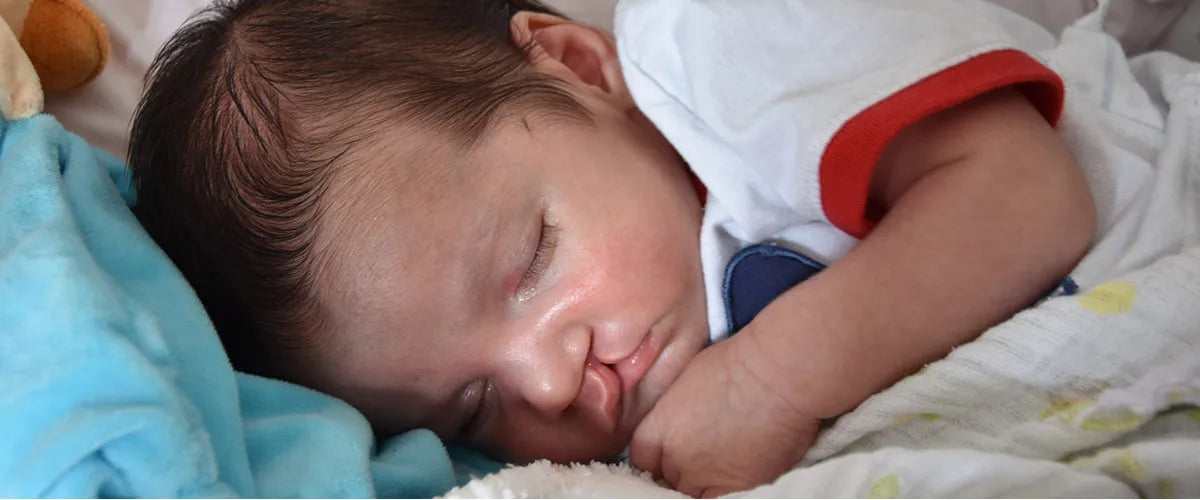 Cleft lip and palate in simple terms