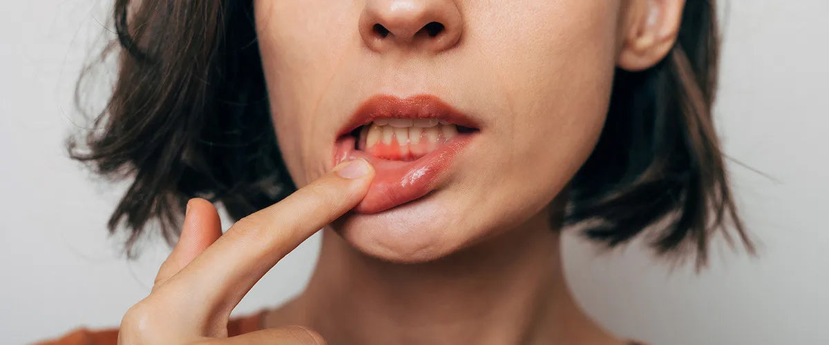 Gum cancer: Symptoms and treatment Gum cancer: Symptoms and treatment