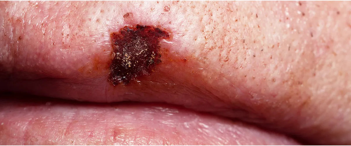 health effects of tobacco The Effects of Tobacco Smoking #HealthTips #Health #NTRTrust