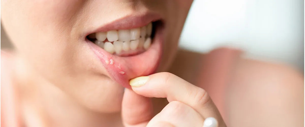 Stomatitis: What helps with inflammation of the oral mucosa?