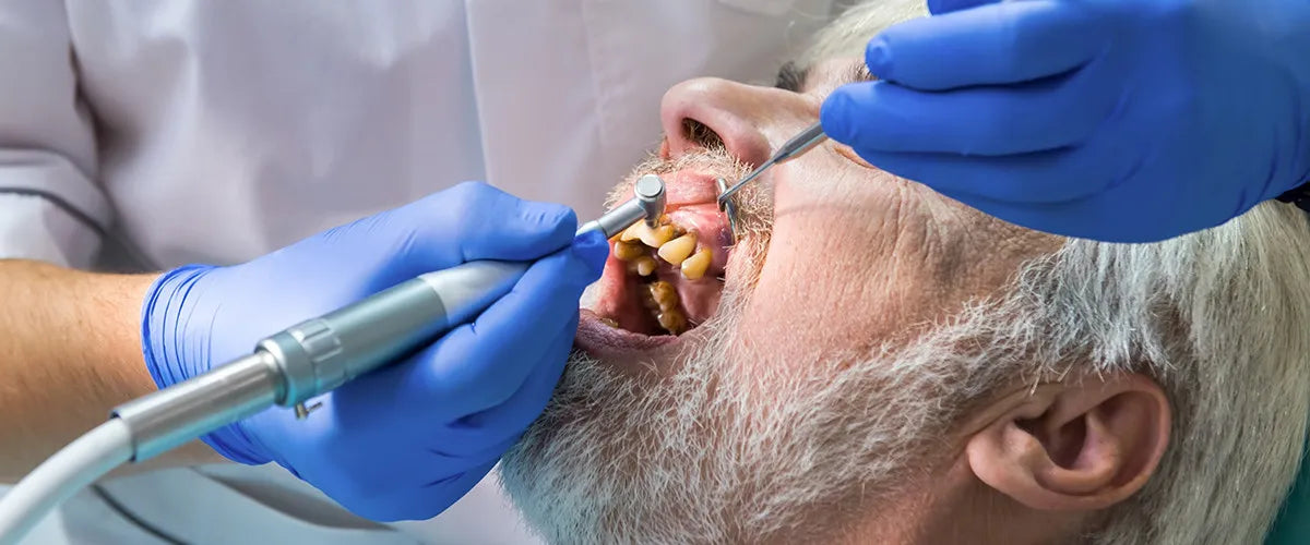 Tooth discolouration: Where it comes from and how it disappears