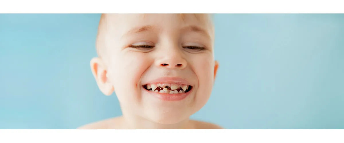 Caries: Treatment and prevention