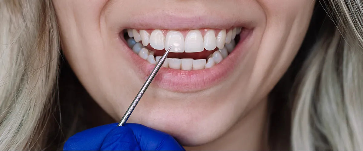 Fluorosis in children and babies: What to do?