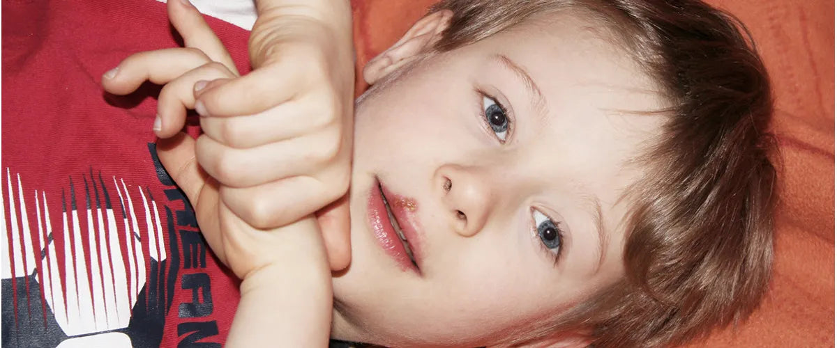 Preventing and treating herpetic stomatitis