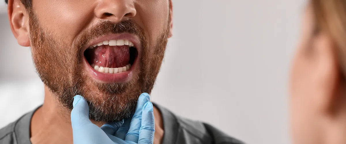 Treating and preventing mucositis