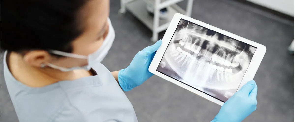 What needs to be considered when X-raying teeth?